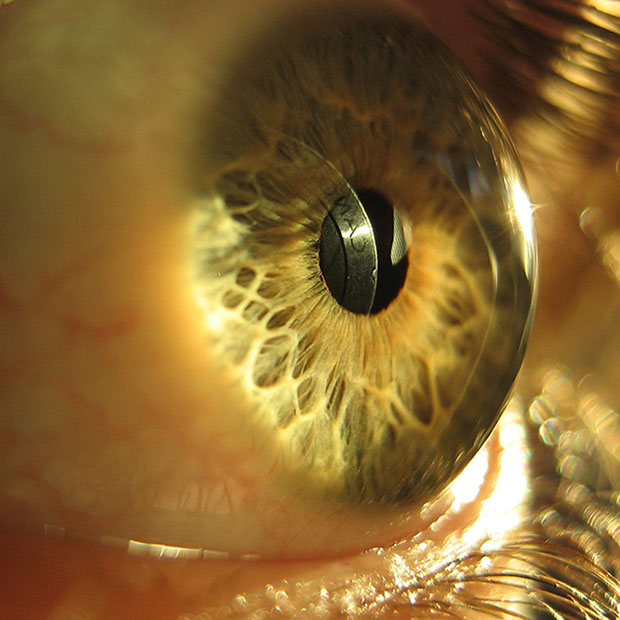 The Mechanics Of Eyesight Kent WA Benson/Kent Vision Source